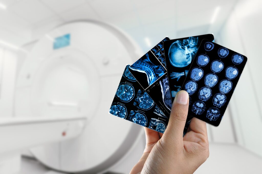 Hands hold MRI scan of head, neck and brain of patient, holding in hands.