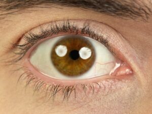 Brown eye