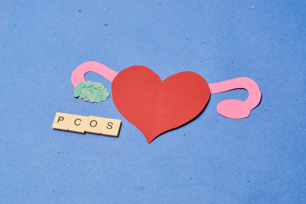 Concept polycystic ovary syndrome, PCOS. Women reproductive system