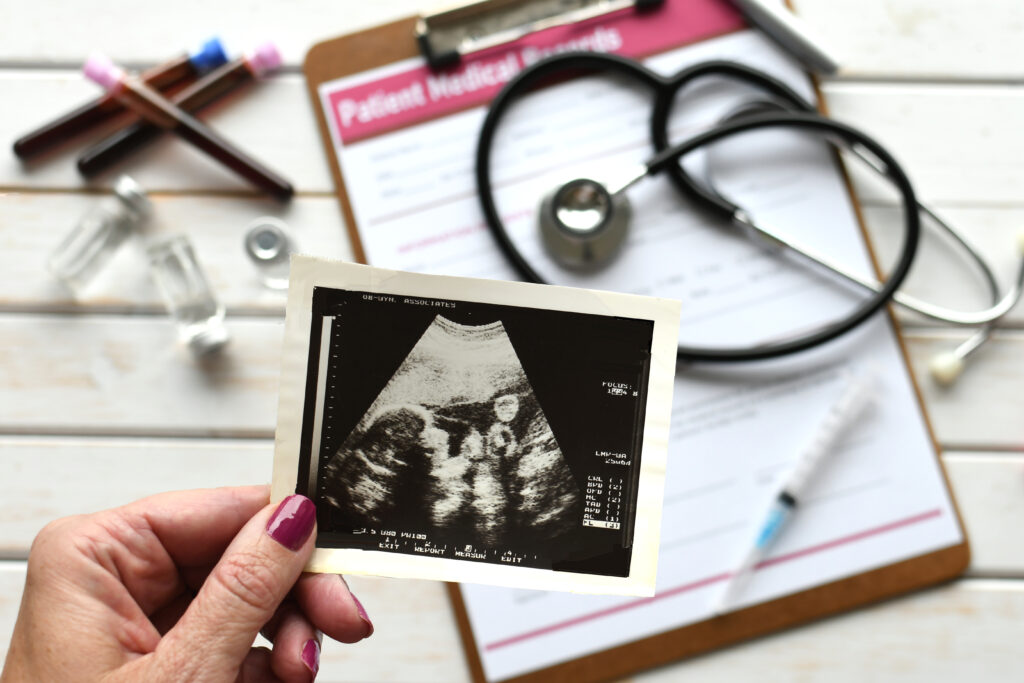 Female holding ultrasound of baby fetus - concept for IVF or prenatal medical care in utero