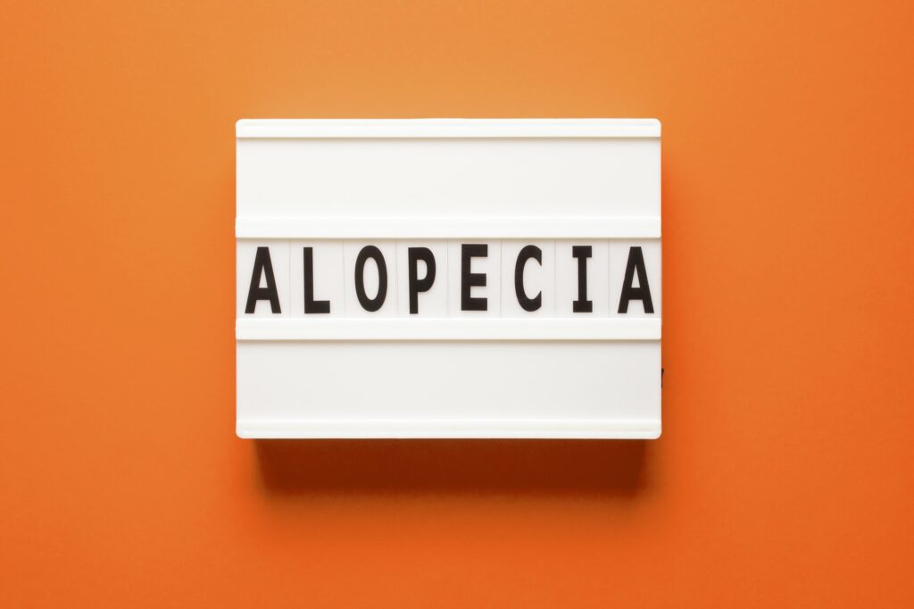 Lightbox with word alopecia on orange background, top view. Medical concept