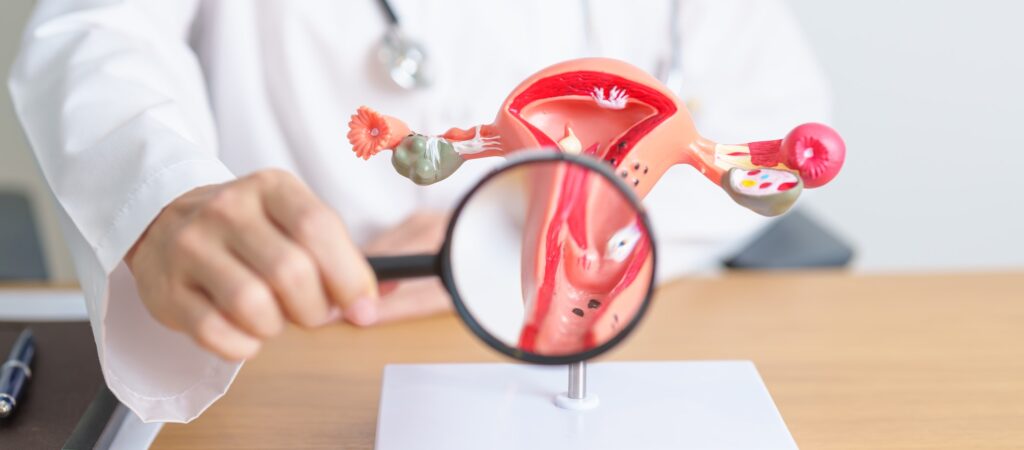 Doctor with Uterus and Ovaries anatomy model