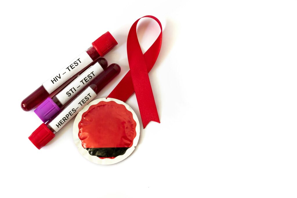 AIDS ribbon with blood tubes from sexually transmitted disease tests and condom on white background
