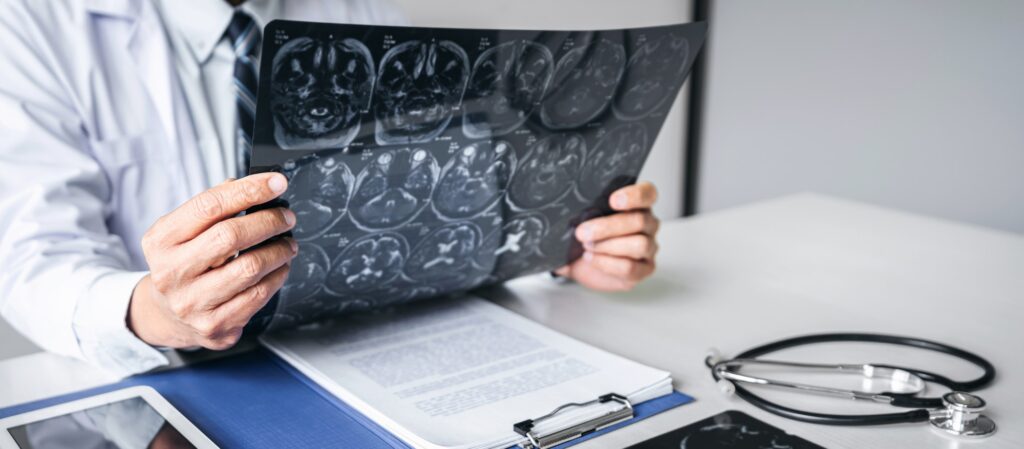 Doctor hands holding patient brain x-ray film before treatment a