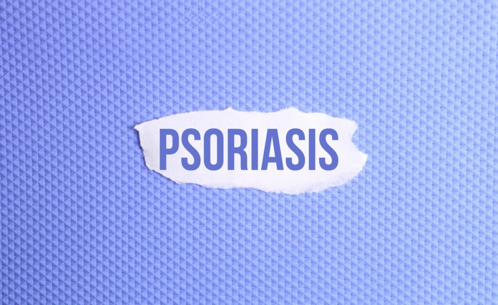 a torn paper written with inscription psoriasis on a blue background