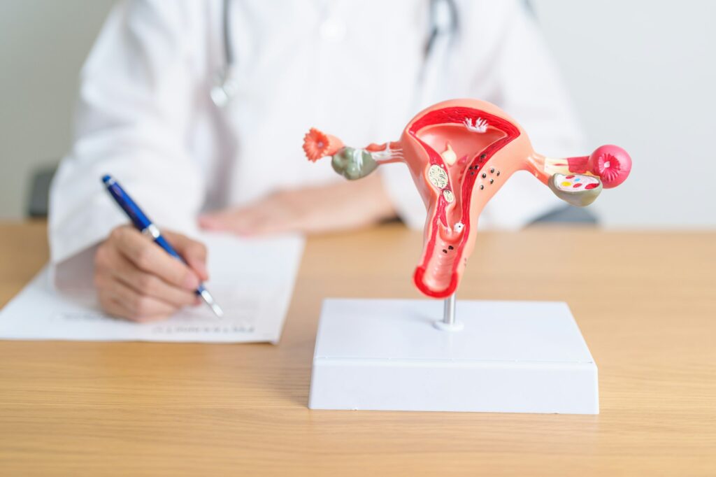 Doctor with Uterus and Ovaries anatomy model.