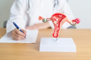Doctor with Uterus and Ovaries anatomy model.