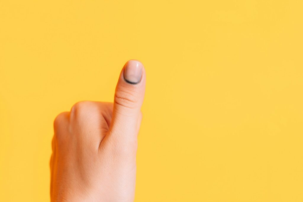 Hematoma under the nail with manicure on the thumb against a yellow background