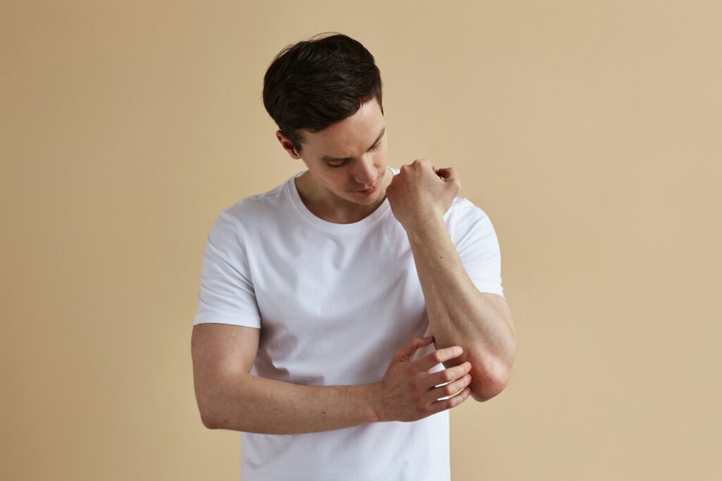 Minimal man scratching skin psoriasis