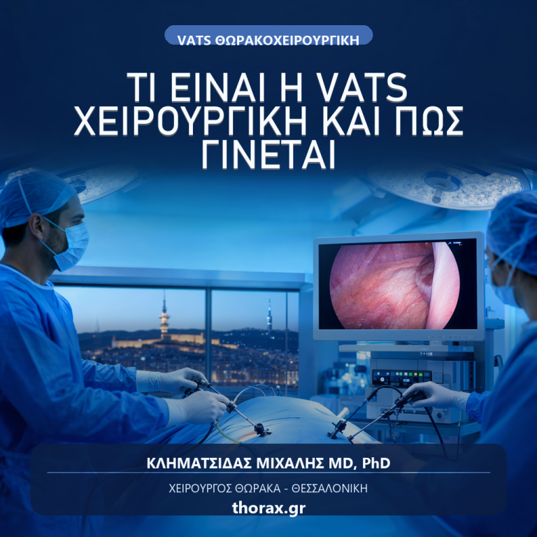Τετράγωνη branded featured image για άρθρο σχετικά με το τι είναι η VATS χειρουργική και πώς γίνεται η επέμβαση
