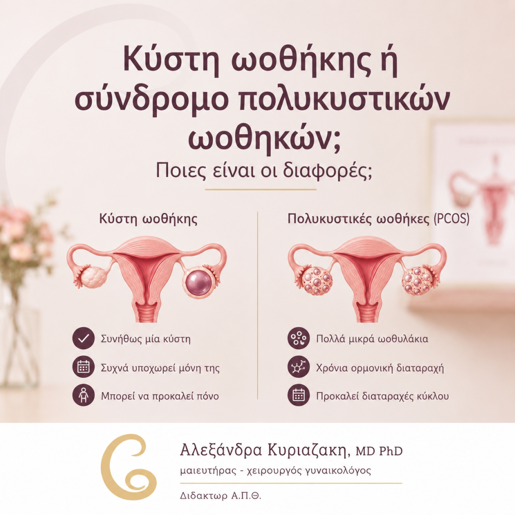Κύστη ωοθήκης ή σύνδρομο πολυκυστικών ωοθηκών; Ποιες είναι οι διαφορές;